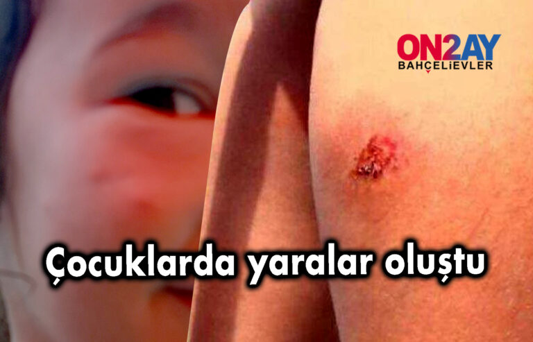 İstanbul'da sivrisinek