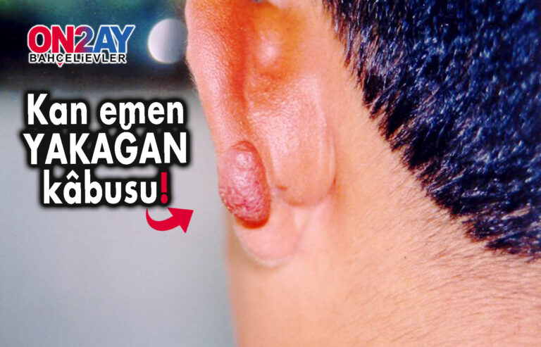 Kan emen YAKAĞAN kâbusu!