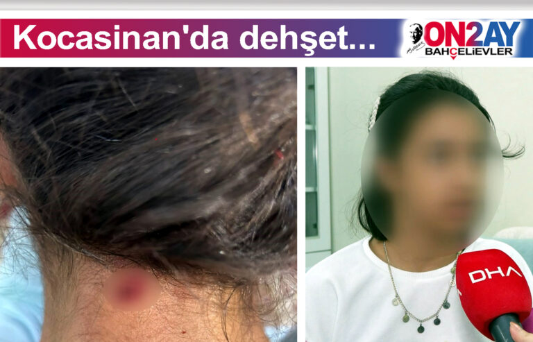 Kocasinan'da dehşet, kızın boynuna kurşun geldi