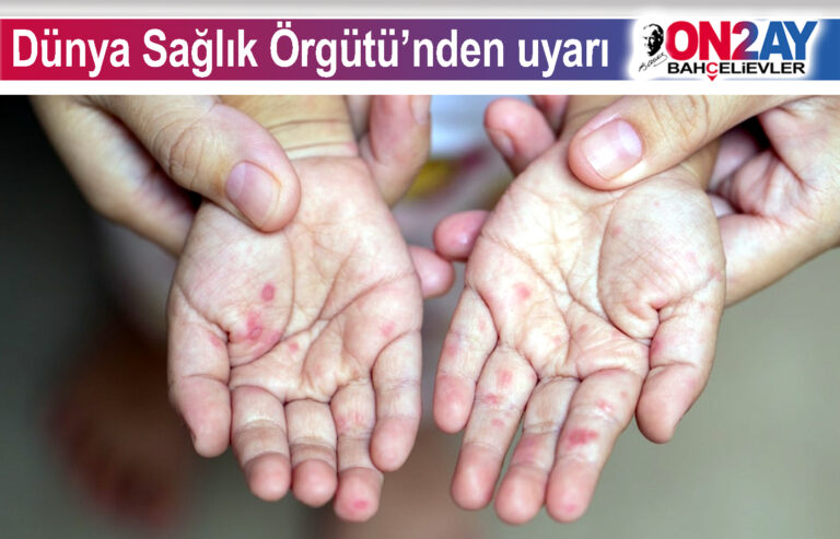 Dünya Sağlık Örgütü’nden kızamık uyarısı
